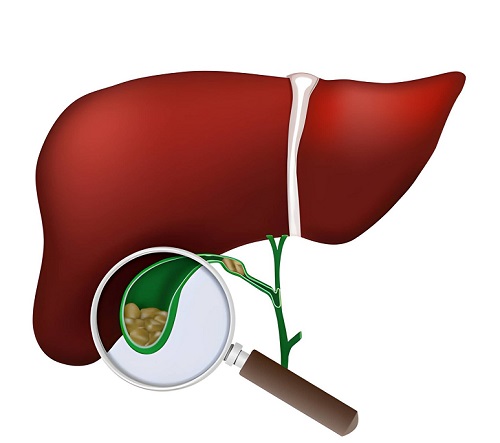 Best Gall Bladder in Mumbai